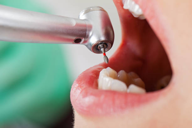 Best Emergency Dentist for Special Needs Patients in Centerville, IN